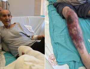 Herkesin başına gelebilir! Tıkalı lavaboyu açmak isterken yandı