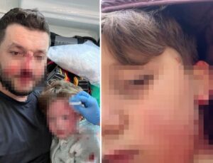 Yalova’da husumet büyüyor: Aynı ailenin 8 yaşındaki çocuğu da yaralandı